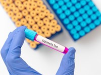 Esta Semana Santa, ¡tratamiento contra la legionella!